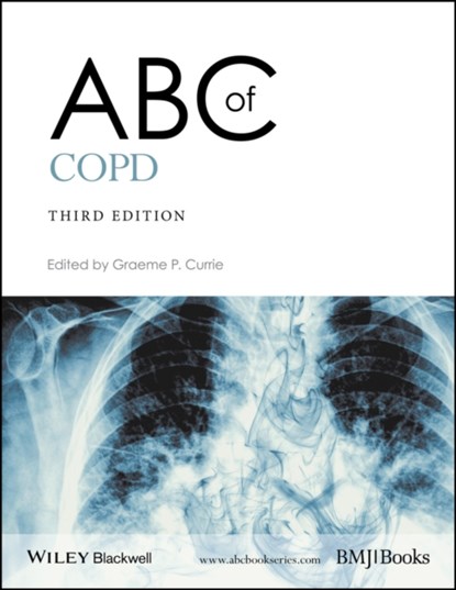 ABC of COPD, Graeme P. (Aberdeen Royal Infirmary Currie - Paperback - 9781119212850