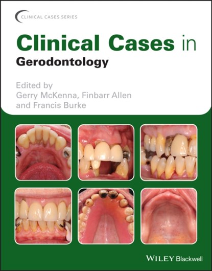 Clinical Cases in Gerodontology, Gerry McKenna ; Finbarr Allen ; Francis Burke - Paperback - 9781119226598
