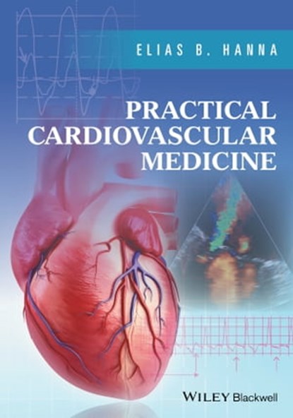 Practical Cardiovascular Medicine, Elias B. Hanna - Ebook - 9781119233497