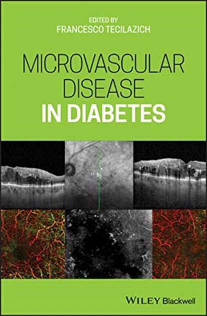 Microvascular Disease in Diabetes, Francesco Tecilazich - Gebonden - 9781119309604