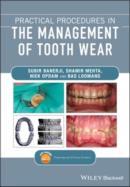 Practical Procedures in the Management of Tooth Wear, Subir Banerji ; Shamir B. Mehta ; Niek Opdam ; Bas Loomans - Ebook - 9781119389927