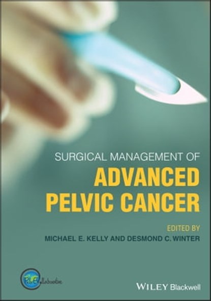 Surgical Management of Advanced Pelvic Cancer, Desmond C. Winter ; Michael E. Kelly - Ebook - 9781119518433