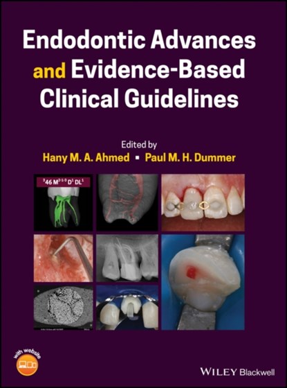 Endodontic Advances and Evidence-Based Clinical Guidelines, Hany M. A. Ahmed ; Paul M. H. Dummer - Gebonden - 9781119553885