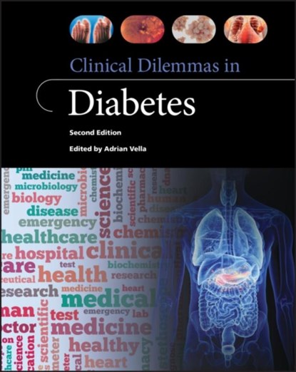 Clinical Dilemmas in Diabetes, Adrian (Department of Endocrinology Vella - Paperback - 9781119603160