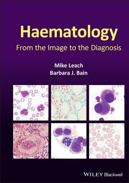 Haematology, MIKE (GARTNAVEL GENERAL HOSPITAL,  Glasgow, UK) Leach ; Barbara J. (St Mary's Hospital, London, UK) Bain - Gebonden - 9781119777502