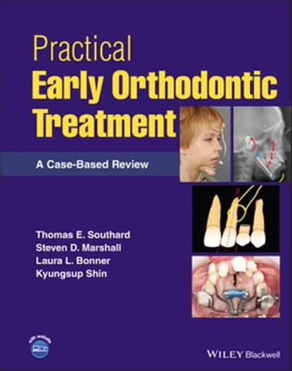 Practical Early Orthodontic Treatment, Thomas E. Southard ; Steven D. Marshall ; Laura L. Bonner ; Kyungsup Shin - Ebook - 9781119793618