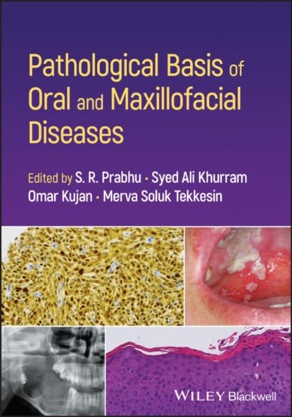 Pathological Basis of Oral and Maxillofacial Diseases, S. R. (University of Queensland Prabhu ; Syed Ali (University of Sheffield Khurram ; Omar (University of Western Australia Kujan - Paperback - 9781119989202