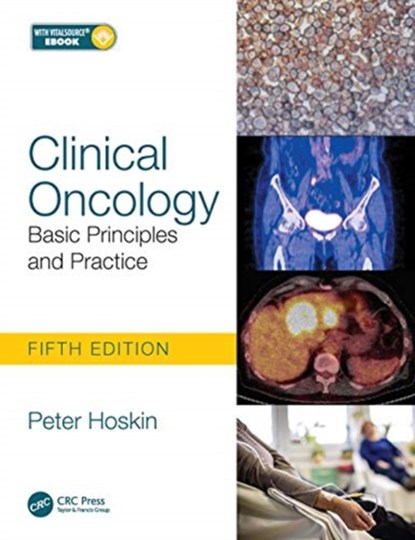 Clinical Oncology, PETER (UNIVERSITY OF MANCHESTER,  Manchester, UK, Mount Vernon Hospital, Northwood, London, UK, University College London Hospitals, London, UK and the Christie Hospital, Manchester, UK) Hoskin - Paperback - 9781138035553