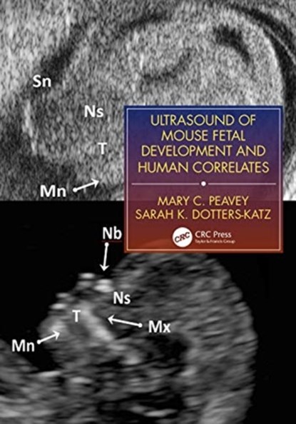 Ultrasound of Mouse Fetal Development and Human Correlates, Mary C. Peavey ; Sarah K. Dotters-Katz - Paperback - 9781138071216
