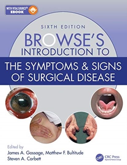 Browse's Introduction to the Symptoms & Signs of Surgical Disease, James A. (King’s College London Gossage ; Matthew F. (Guy's and St Thomas' Hospitals NHS Foundation Trust Bultitude ; Steven A. (Guy's and St Thomas' NHS Foundation Trust Corbett - Paperback - 9781138330085