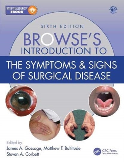 Browse's Introduction to the Symptoms & Signs of Surgical Disease, James A. (King’s College London Gossage ; Matthew F. (Guy's and St Thomas' Hospitals NHS Foundation Trust Bultitude ; Steven A. (Guy's and St Thomas' NHS Foundation Trust Corbett - Gebonden - 9781138330405