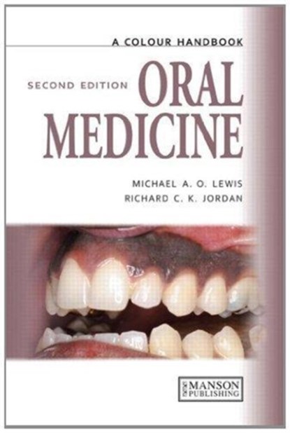 Oral Medicine, Michael Lewis ; Richard Jordan - Paperback - 9781138494183