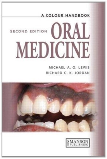 Oral Medicine, Michael (Professor of Oral Medicine Lewis ; Richard (Oral Pathologist Jordan - Paperback - 9781138494183