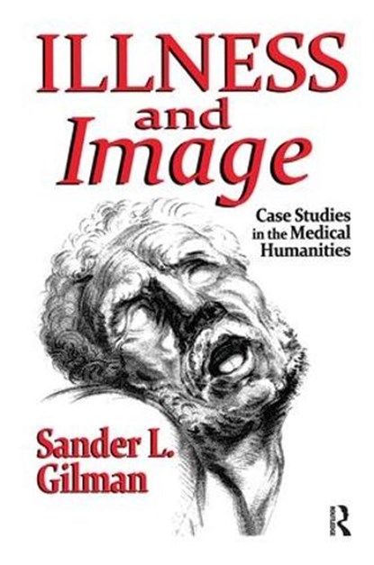 Illness and Image, Sander L. Gilman - Paperback - 9781138510791