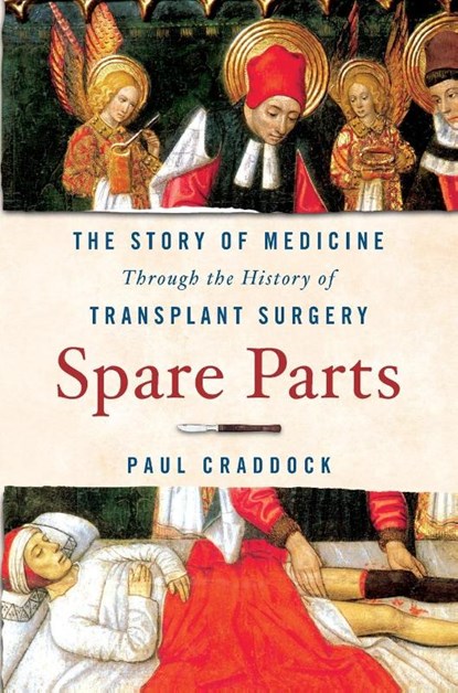 Spare Parts, Paul Craddock - Paperback - 9781250409539