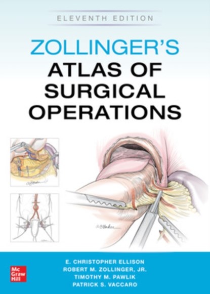 Zollinger's Atlas of Surgical Operations, Eleventh Edition, Robert Zollinger ; E. Ellison ; Timothy Pawlik ; Patrick Vaccaro - Paperback - 9781260440850