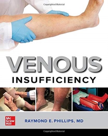 Venous Insufficiency, Raymond E. Phillips - Paperback - 9781260461268