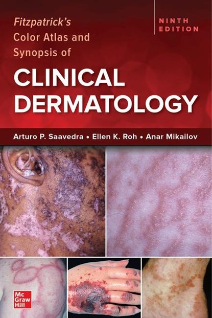 Fitzpatrick's Color Atlas and Synopsis of Clinical Dermatology, Ninth Edition, Arturo Saavedra ; Ellen Roh ; Anar Mikailov - Paperback - 9781264278015