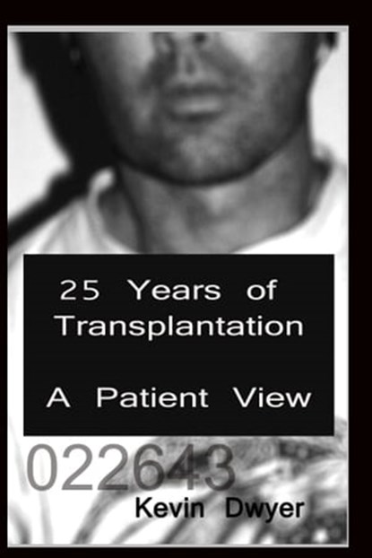 25 Years of Transplantation - A Patient View, Kevin Dwyer - Ebook - 9781301084654