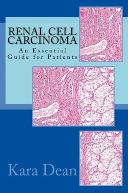 Renal Cell Carcinoma: An Essential Guide for Patients, Kara Dean - Ebook - 9781310051142