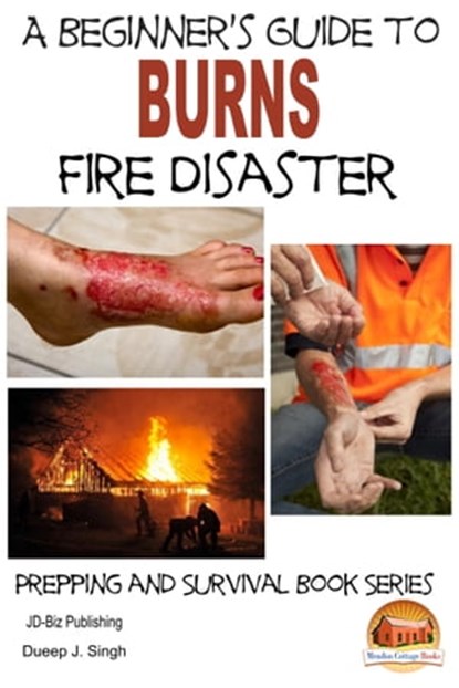 A Beginner's Guide to Burns: Fire Disaster, Dueep J. Singh - Ebook - 9781310665103