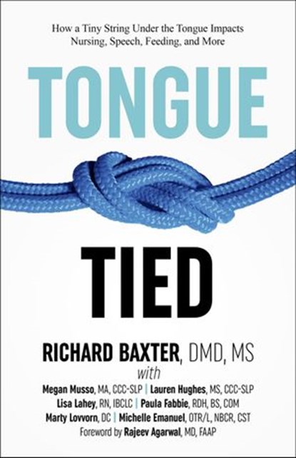 Tongue-Tied: How a Tiny String Under the Tongue Impacts Nursing, Speech, Feeding, and More, Richard Baxter - Ebook - 9781386058342