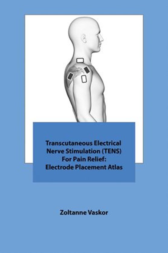 Transcutaneous Electrical Nerve Stimulation (TENS) For Pain Relief: Electrode Placement Atlas