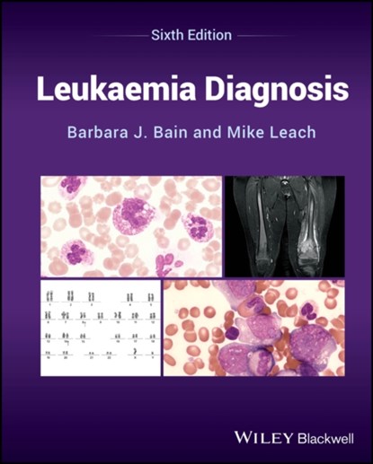 Leukaemia Diagnosis, BARBARA J. (ST MARY'S HOSPITAL,  London, UK) Bain ; Mike (Gartnavel General Hospital, Glasgow, UK) Leach - Gebonden - 9781394218585