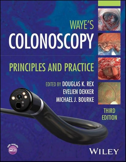 Colonoscopy, Douglas K. (Indiana University Medical Center Rex ; Evelien (University of Amsterdam Dekker ; Michael J. (University of Sydney) Bourke - Paperback - 9781394220250
