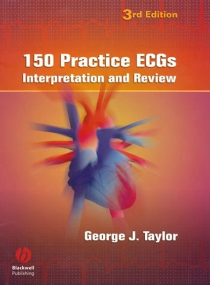 150 Practice ECGs, GEORGE J. (MEDICAL UNIVERSITY OF SOUTH CAROLINA,  Charleston, SC, USA) Taylor - Paperback - 9781405104838