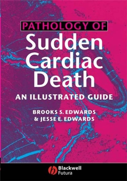Pathology of Sudden Cardiac Death, BROOKS S. (MAYO CLINIC ROCHESTER,  MN) Edwards ; Jesse E. (United Hospital, St. Paul, MN) Edwards - Gebonden - 9781405122122