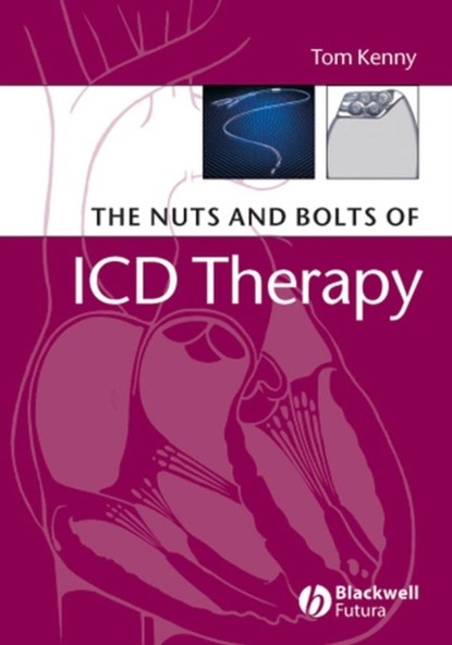 The Nuts and Bolts of ICD Therapy, TOM (ST. JUDE MEDICAL,  Austin, Texas) Kenny - Paperback - 9781405135115