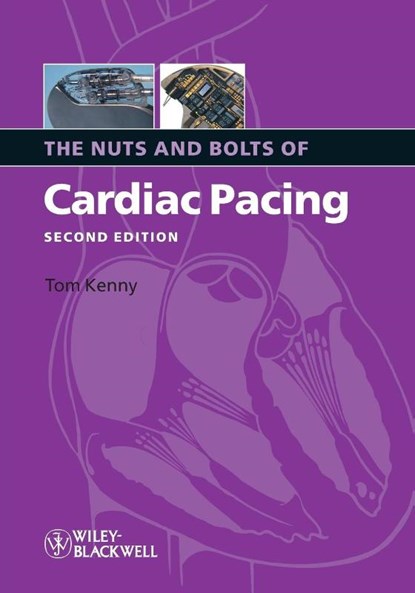 The Nuts and Bolts of Cardiac Pacing, Tom (St. Jude Medical Kenny - Paperback - 9781405184038