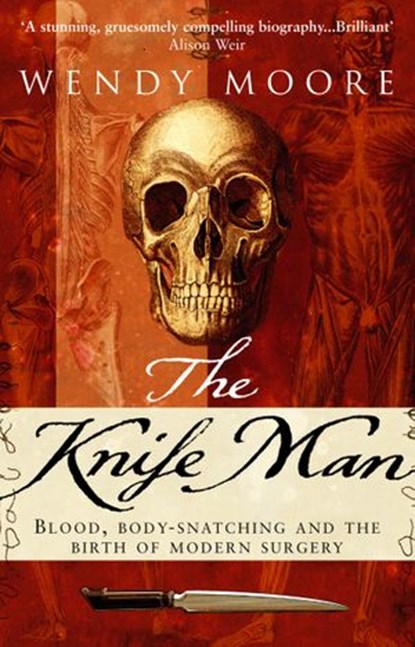The Knife Man, Wendy Moore - Ebook - 9781409044628