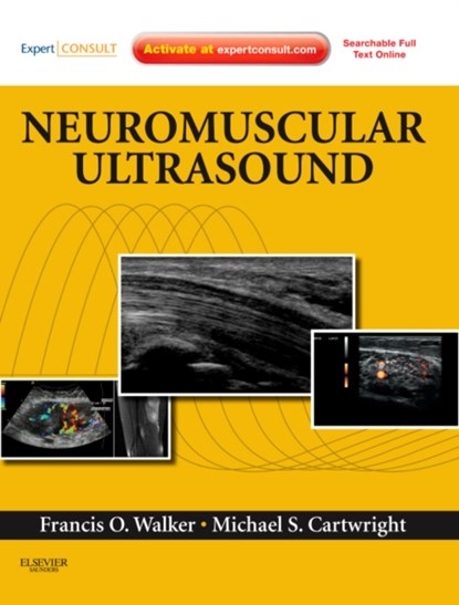 Neuromuscular Ultrasound, Francis (Emeritus Professor of Neurology; Wake Forest University School of Medicine; Winston-Salem Walker ; Michael S. (Assistant Professor of Neurology Cartwright - Gebonden - 9781437715279