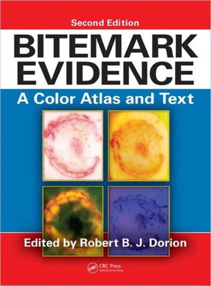 Bitemark Evidence, ROBERT B.J. (DIRECTOR OF FORENSIC DENTISTRY,  Laboratoire de Sciences Judiciaires et de Medecine Legale, Montreal, Quebec, Canada) Dorion - Gebonden - 9781439818626