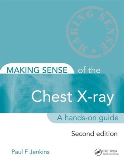 Making Sense of the Chest X-ray, PAUL (FORMERLY WINTHROP PROFESSOR OF ACUTE MEDICINE AT THE UNIVERSITY OF WESTERN AUSTRALIA AND CONSULTANT PHYSICIAN,  Norfolk and Norwich University Hospital, UK) Jenkins - Paperback - 9781444135152