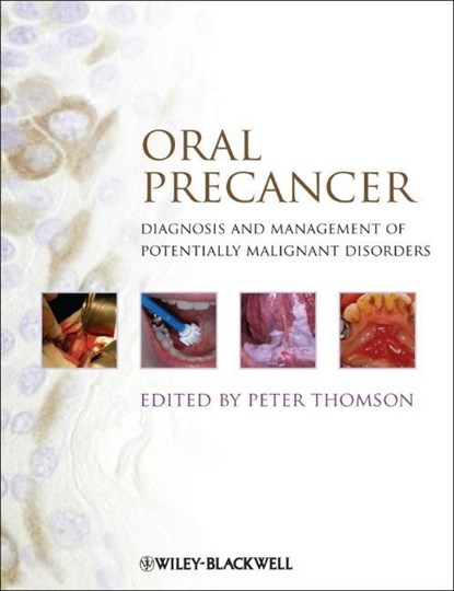 Oral Precancer, PETER (SCHOOL OF DENTAL SCIENCES,  Newcastle-upon-Tyne, UK) Thomson - Gebonden - 9781444335743