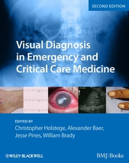 Visual Diagnosis in Emergency and Critical Care Medicine, Christopher P. Holstege ; Alexander B. Baer ; Jesse M. Pines ; William J. Brady - Ebook - 9781444398007