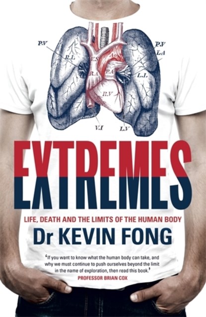 Extremes, Kevin Fong - Paperback - 9781444737776