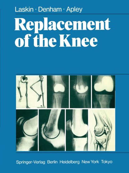 Replacement of the Knee, R.S. Laskin ; R.A. Denham ; A.G. Apley - Paperback - 9781447113553