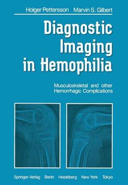 Diagnostic Imaging in Hemophilia, H. Pettersson ; M.S. Gilbert - Paperback - 9781447113744
