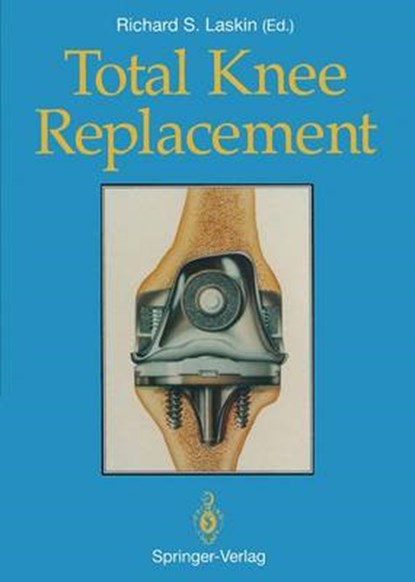 Total Knee Replacement, Richard S. Laskin - Paperback - 9781447118275