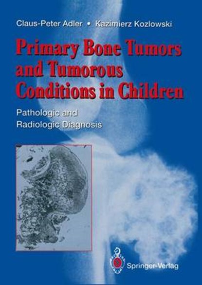 Primary Bone Tumors and Tumorous Conditions in Children, Claus-Peter Adler ; Kazimierz Kozlowski - Paperback - 9781447119531