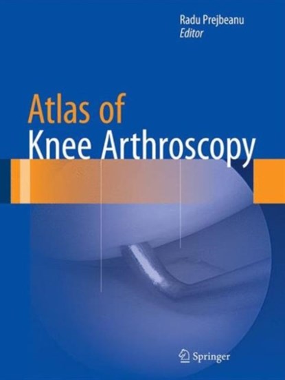 Atlas of Knee Arthroscopy, Radu Prejbeanu - Gebonden - 9781447165927