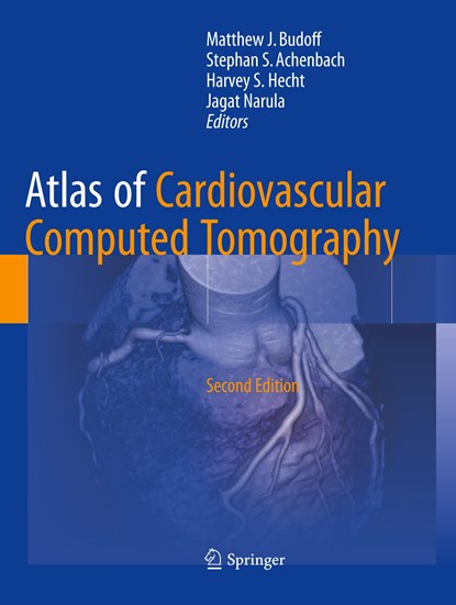 Atlas of Cardiovascular Computed Tomography, Matthew J. Budoff ; Stephan S. Achenbach ; Harvey S. Hecht ; Jagat Narula - Paperback - 9781447174332