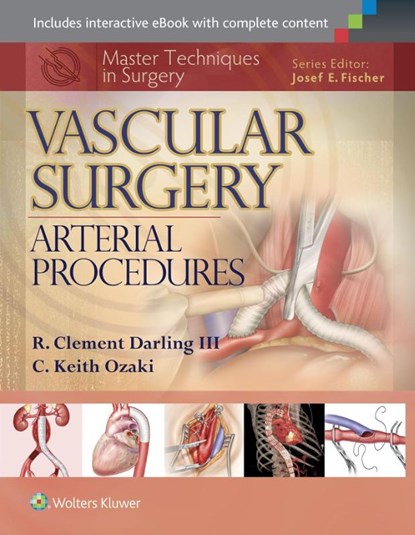 Master Techniques in Surgery: Vascular Surgery: Arterial Procedures, R. Clement Darling ; C. Keith Ozaki - Gebonden - 9781451191615