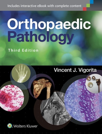 Orthopaedic Pathology, Vincent J. Vigorita - Gebonden - 9781451192025