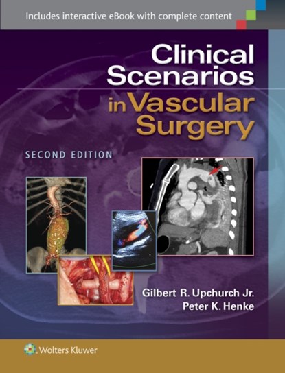 Clinical Scenarios in Vascular Surgery, GILBERT R.,  Jr., MD Upchurch ; Peter K. Henke - Gebonden - 9781451192131