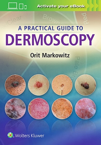 A Practical Guide to Dermoscopy, Orit Markowitz - Gebonden - 9781451192636